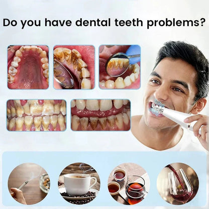 Teeth Flosser