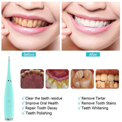 Teeth Flosser