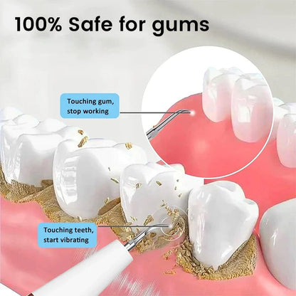 Teeth Flosser